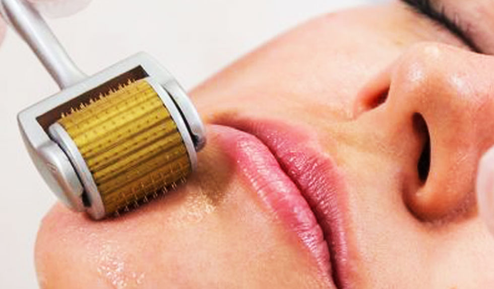 Enrol for Microneedling Course Before the Offer Ends