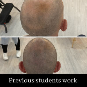 Scalp Micropigmentation Course. SALE PRICE- £1999 normally £2999 (including FULL kit)