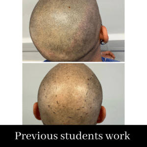 Scalp Micropigmentation Course. SALE PRICE- £1999 normally £2999 (including FULL kit)