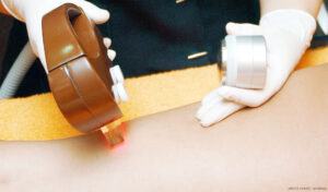 Scottish beauty expert meshotheraphy treatment