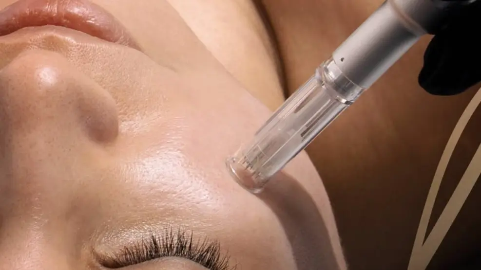 Focus Awards Level 4 Certificate in Skin Needling Treatments