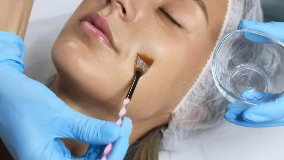 ofqual Chemical peel Treatments
